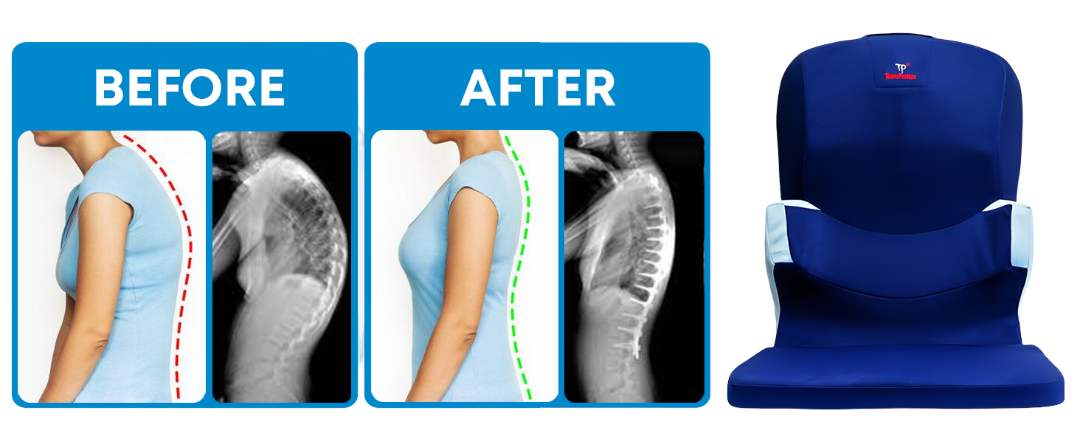 Posture Comparison